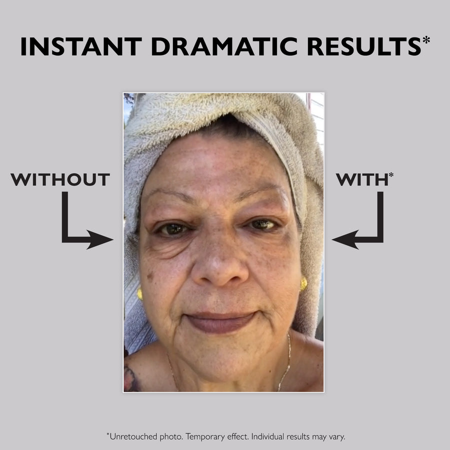 Eyelixir™ 5-Minute Eye Lift — Say goodbye to puffiness and fine lines