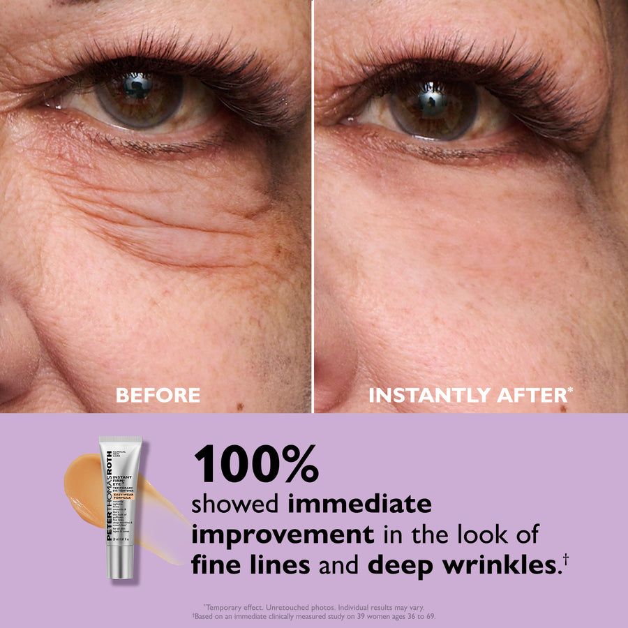Eyelixir™ 5-Minute Eye Lift — Say goodbye to puffiness and fine lines