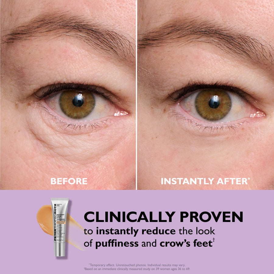 Eyelixir™ 5-Minute Eye Lift — Say goodbye to puffiness and fine lines