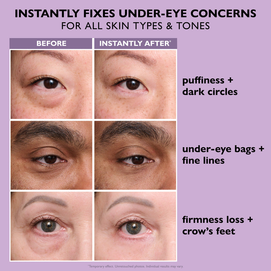 Eyelixir™ 5-Minute Eye Lift — Say goodbye to puffiness and fine lines