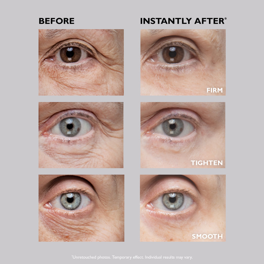 Eyelixir™ 5-Minute Eye Lift — Say goodbye to puffiness and fine lines