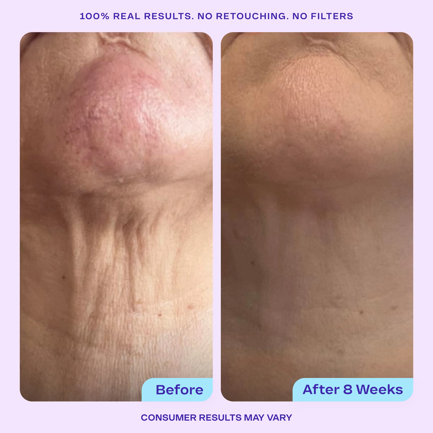 Lisséderm Tighten & Lift Neck Cream