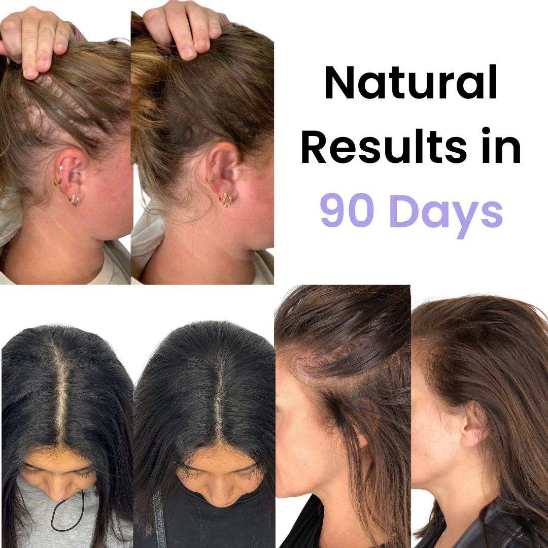 TheraComb™ Hair Regrowth Brush + FREE Scalp Therapy Serum