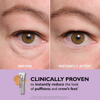 Eyelixir™ 5-Minute Eye Lift — Say goodbye to puffiness and fine lines