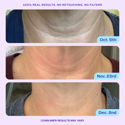 Lisséderm Tighten & Lift Neck Cream