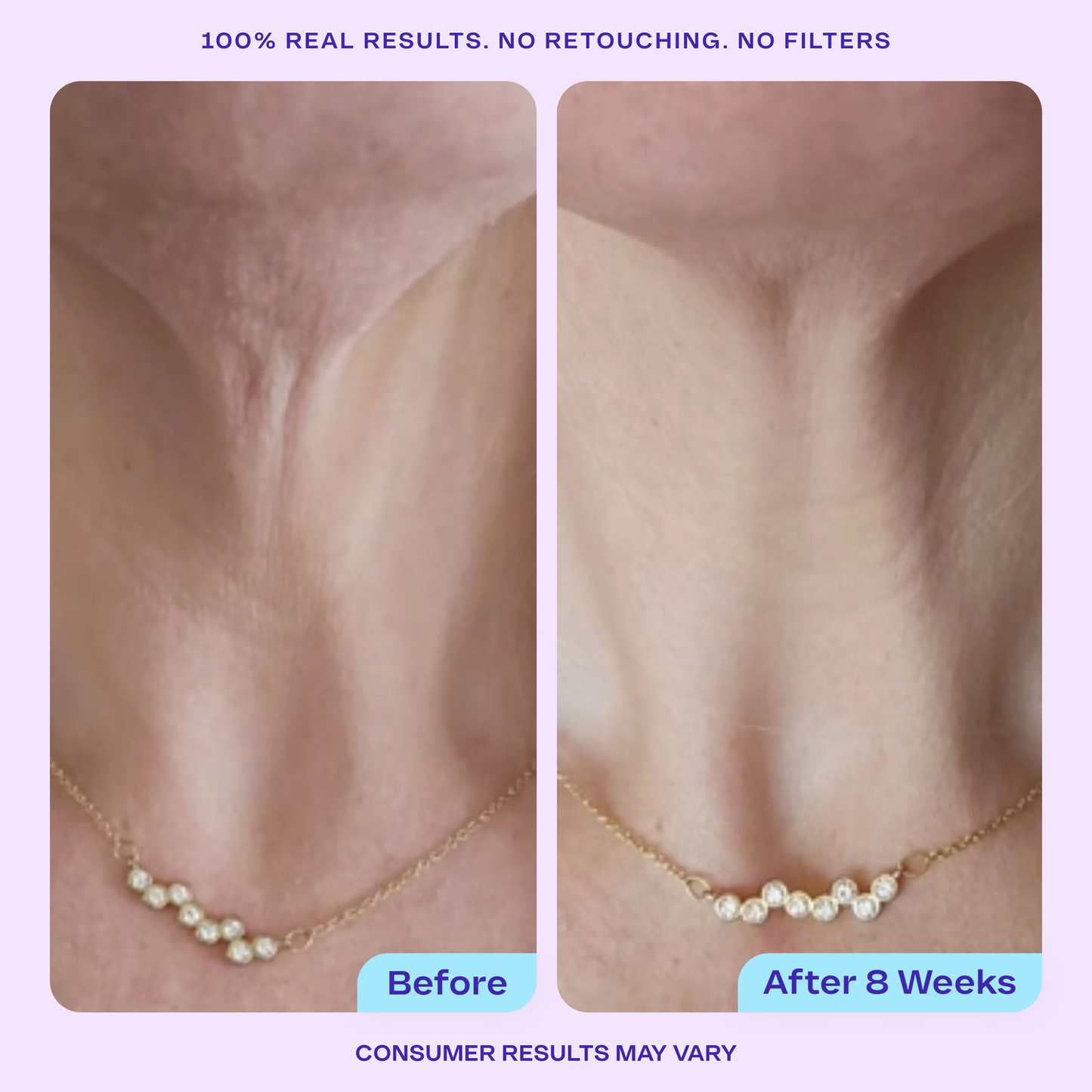Lisséderm Tighten & Lift Neck Cream