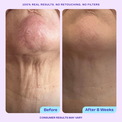 Lisséderm Tighten & Lift Neck Cream